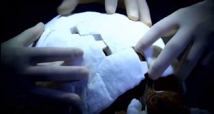 His shell was severely damaged, so a bunch of volunteers used a 3D printer to create a new one for him.