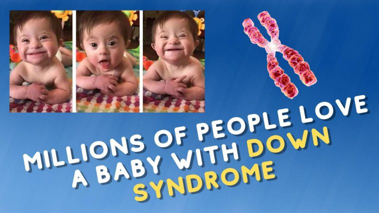 Millions Of People Love A Baby With Down Syndrome