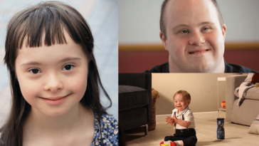 A Baby Model with Syndrome appeared in an Ad that goes viral now
