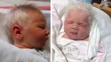 Baby Boy Born With Snow-White Hair Dubbed Prince Charming