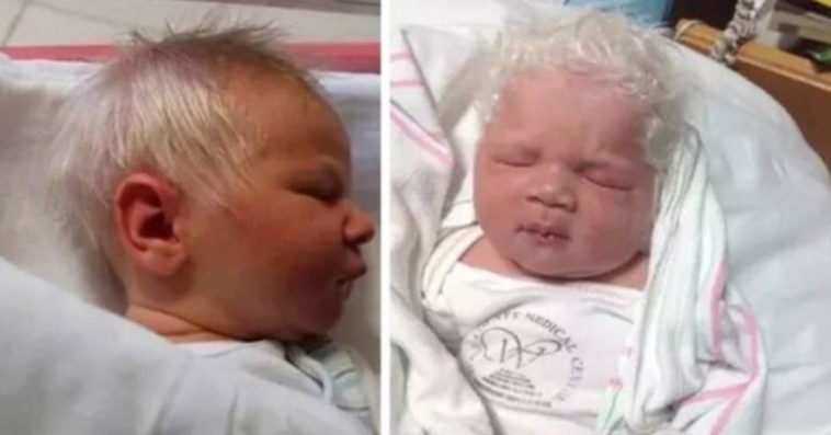 Baby Boy Born With Snow-White Hair Dubbed Prince Charming