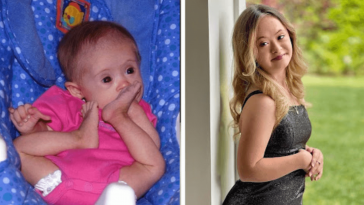 Top 5 helpful devices for seniors