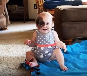 Nicole claimed on GMA that despite the challenges she has, Winry is the picture of a content baby in her day-to-day life as a developing child