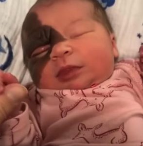 Nicole spoke candidly on Good Morning America about her goal to raise awareness of Winry's condition