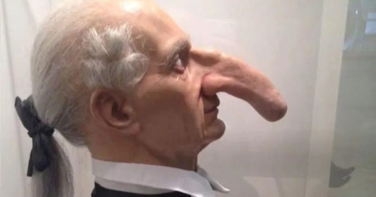 The Yorkshireman With The "Longest Nose In The World"